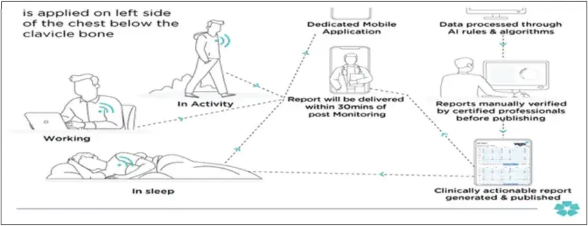 schematic-representation