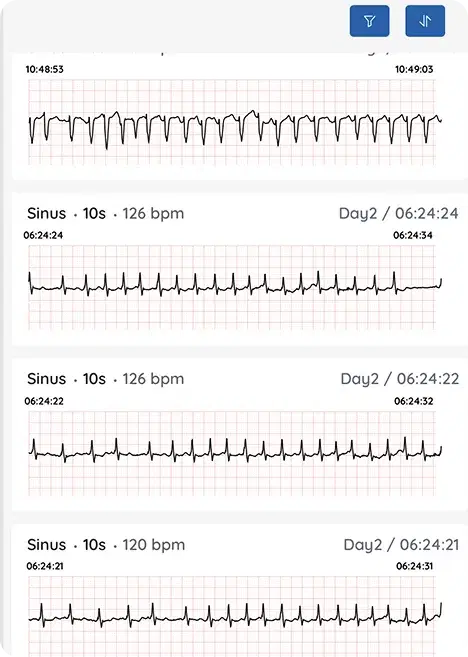 Arrhythmia Summary